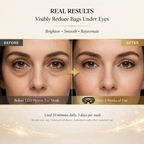 Before and after effect of LED Photon Eye Mask on reducing bags under eyes.