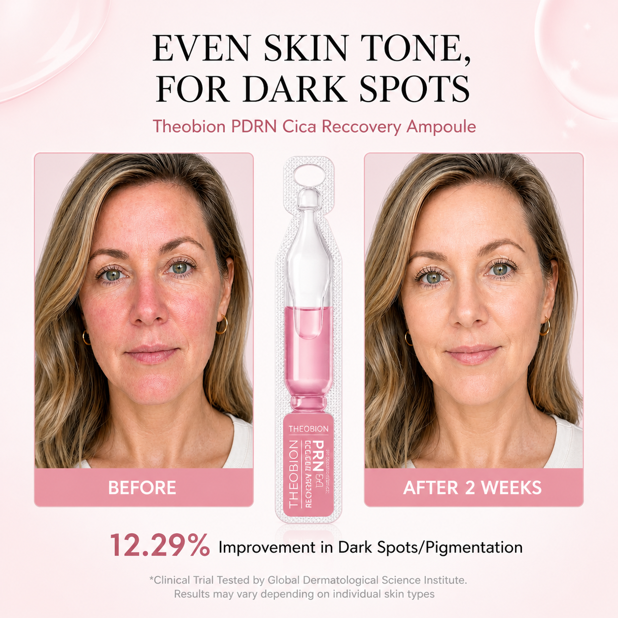 Before and after comparison of a woman's skin with Theobion PDRN Cica Reccovery Ampoule, showing 12.29% improvement in dark spots/pigmentation.