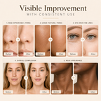 Theobion YouthRestore Face & Neck Light Therapy System
