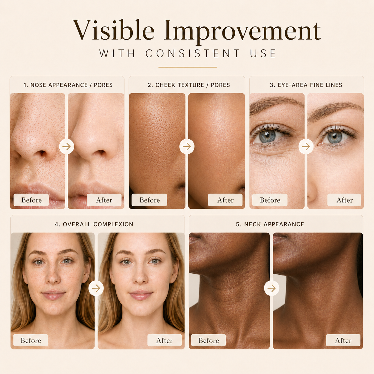 Theobion YouthRestore Face & Neck Light Therapy System